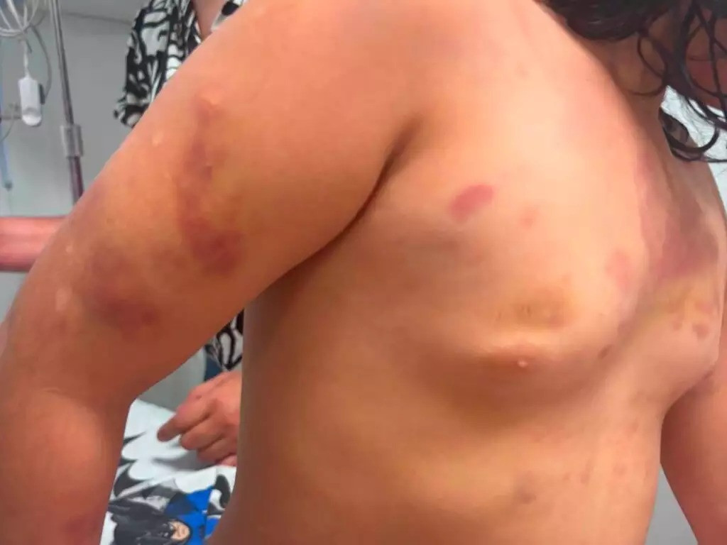 Menina autista agredida no Paraguai: família denuncia extorsão,...